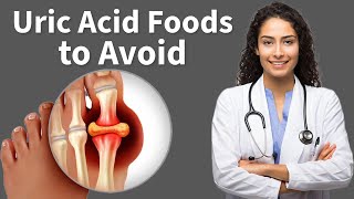 High Uric Acid Foods you should Avoid [upl. by Joannes]