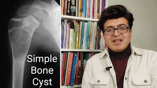 Review of simple bone cyst Radiology Xrays and CT images [upl. by Anividul]