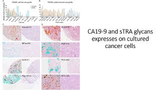 sTRA amp CA199 glycans express on cultured pancreatic cancer cells Code 696 [upl. by Anivlem]