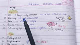 Keratitis Part 2 bacterial corneal ulcer theory notes  AK KHURANA [upl. by Jozef]