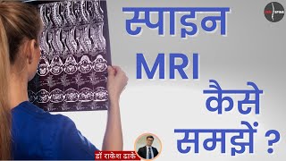 स्वयं स्पाइन MRI समझें एक आसान मार्गदर्शिका Reading Your Spine MRI Hindi [upl. by Evangelina820]