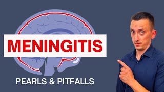 BACTERIAL MENINGITIS IN ADULTS SYMPTOMS CAUSES DIAGNOSIS AND TREATMENT [upl. by Haman960]