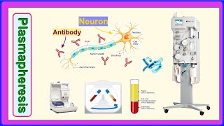 plasmapheresis [upl. by Renwick]