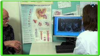 Behandling av prostatakreft [upl. by Niltyak]