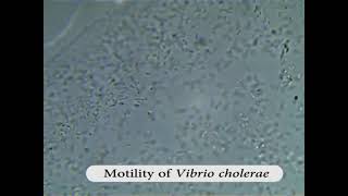 Bacteria motility1  Darting  V cholera [upl. by Nodnorb]