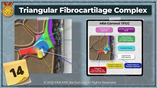 KOR Anatomy14 Triangular fibrocartilage complex TFCC wrist MRI [upl. by Afra]