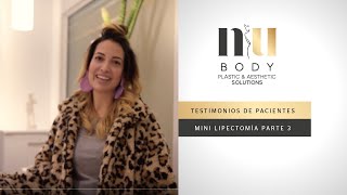 Testimonio de Minilipectomía y Liposucción NuBody  Parte 3 [upl. by Schroder]