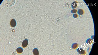 Fungi spores under microscope [upl. by Anihtyc]