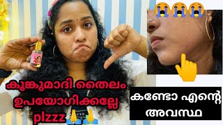 2 ആഴ്ച കുങ്കുമാദി തൈലം ഉപയോഗിച്ച എന്റെ skin ന്റെ ഇപ്പോളത്തെ അവസ്ഥ kunkumadi tailam review [upl. by Rodger401]