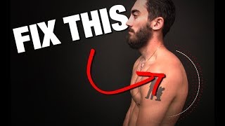 How to Fix Rounded Shoulders GONE IN 4 STEPS [upl. by Virg]