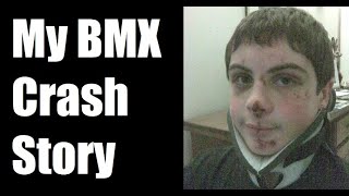 My BMX Crash Story Part 2  My Crash Compared to Scotty Cranmers [upl. by Primrose793]