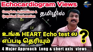 Echo test in tamil  Echo Views  Echocardiogram in 20 min tamil  ps tamil [upl. by Odysseus]