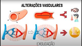 Inflamação Aguda [upl. by Ola]