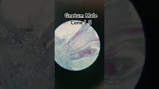 Slide view of gnetum male coneshortvideoscienceshortbotanymicroscopyworldshortvideoshortfeed [upl. by Surat]