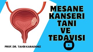 Mesane Kanseri Tanı ve Tedavisi l Prof Dr Tahir Karadeniz [upl. by Wilfred]