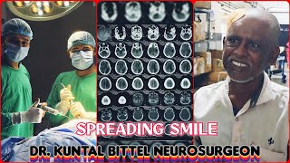 Spreading Smile  Chronic Subdural Hematoma  SDH  Complete Recovery  NEET UG  NEET PG  NEET SS [upl. by Skill]