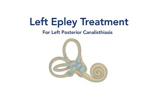 At Home Left Epley Maneuver for BPPV Vertigo [upl. by Anidem376]