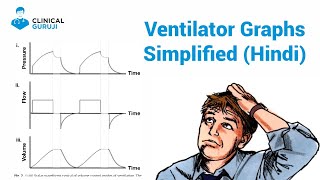 Ventilator Graphics Class  1 Simplified [upl. by Oned]