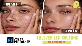 Comment Enlever les Boutons avec Photoshop [upl. by Otreblif43]