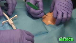 Surgical Cricothyrotomy by the Paramedic Intern [upl. by Basilio]