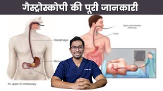 Is Gastroscopy Painful Cost Side Effects Safety Explained  Dr Vishal Tomar  Open Consult [upl. by Laddie]