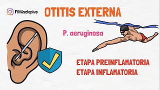 OTITIS EXTERNA AGUDA  DIAGNÓSTICO Y TRATAMIENTO [upl. by Enotna]