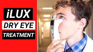 New Revolutionary Dry Eye Treatment  The iLux for Meibomian Gland Dysfunction MGD [upl. by Ninazan]