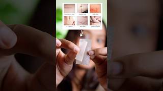 Remove Scar using this 😱‼️ scarremoval acnescars scars [upl. by Adnaluoy]