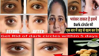 eyes dark circle remove tips  under eye dark circles Dark circles treatment Dr Muzammil Ehsan [upl. by Shaff324]