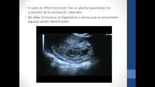 ULTRASONIDO EN OBSTETRICIA II [upl. by Leila]