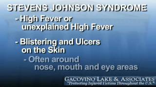 Are You Suffering from StevensJohnson Syndrome NY Attorney Steven Gacovino [upl. by Bartie]