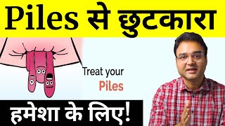 10 Tips To Get Rid Of Piles  Piles Treatment At Home  पाइल्स का इलाज  by Dr Saleem Zaidi [upl. by Rea]