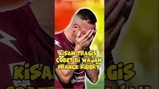 Kisah tragis 100 jahitan di wajah Franck Ribery [upl. by Januarius]