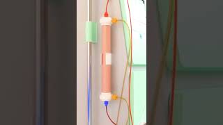 dialysis process animation dialysistechnician kidney bloodcleanser [upl. by Chil]