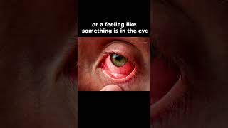 10 Causes Of Eye Pain Or Discomfort  infection [upl. by Demetra]