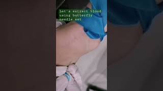 blood extraction venipuncture using butterfly needle set laboratory medtechstudent venipuncture [upl. by Natale606]