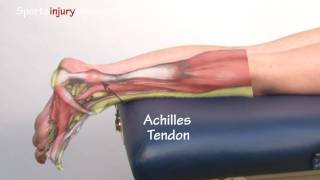 Achilles Tendonitis  Tendinopathy  Explained in 90 Seconds [upl. by Egief]