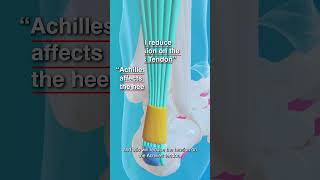 Why Stretching Your Calf Muscles Matters For Achilles Tendinopathy [upl. by Uria]