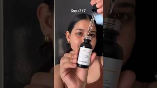 Minimalist 10 Vitamin C Serum Review 7 Days Challenge minimalist vitamincserum ashortsaday [upl. by Molohs]