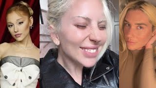 Lady Gaga Reacts To Disease Reception [upl. by Andee]