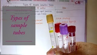 Blood sample collection tubes top colors and anticoagulants mode of action [upl. by Gian]