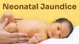 case presentation kse bnye neonatal jaundice prl how to make case presentation on neonatal jaundice [upl. by Conlan]