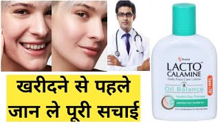 Lacto Calamine Lotion Honest Detailed Review In Hindi  How To Use Lacto Calamine [upl. by Koss]