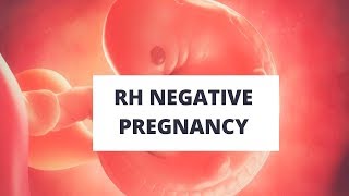 Rh negative pregnancy [upl. by Iey]