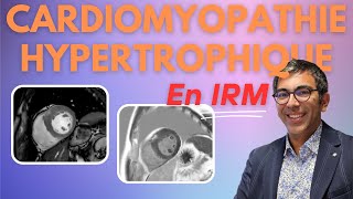 Cardiomyopathie Hypertrophique CMH en IRM  lessentiel en 11 minutes [upl. by Grounds]