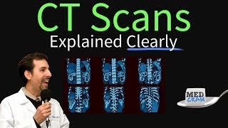 CT Scan of the Chest Explained Clearly  High Resolution CT Scan HRCT [upl. by Oliver]