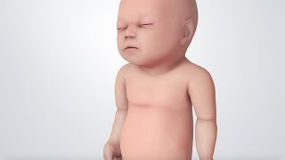 Infant Distress Warning Signs Grunting Baby Sound [upl. by Snyder]