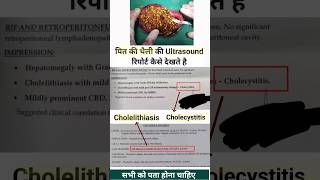 पित्त की थैली की ultrasound report देखना सीखे  Hepatomegaly Fatty liver ultrasound diagnosis [upl. by Sil]