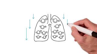 Everything you need to know about the ventilation perfusion ratio [upl. by Atiuqat580]