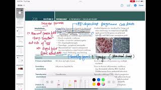 Amyloidosis Pathology 20  First Aid USMLE Step 1 in UrduHindi [upl. by Weaver108]